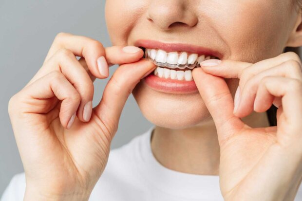 Ortodoncja - aparaty-nakładki invisalign. Fot. mat. prasowy