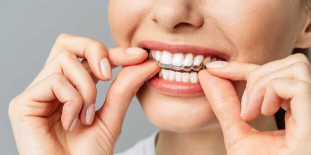 Ortodoncja - aparaty-nakładki invisalign. Fot. mat. prasowy