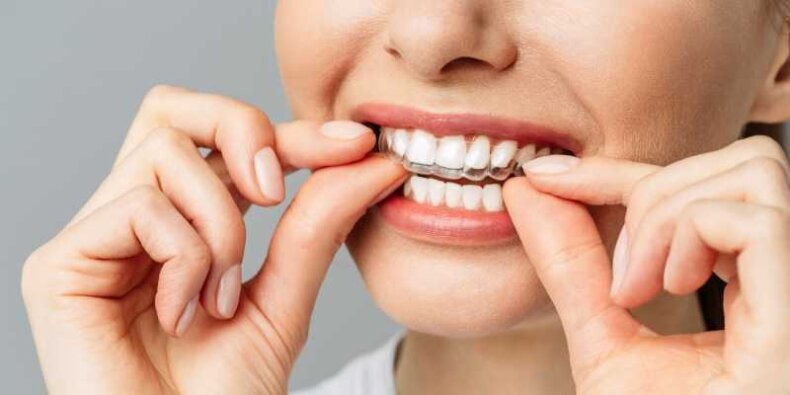 Ortodoncja - aparaty-nakładki invisalign. Fot. mat. prasowy