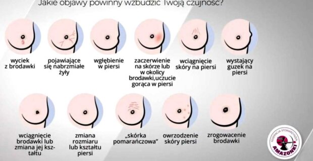 Objawy zmian piersi - badania i profilaktyka najlepszą ochroną. Fot. UMWM