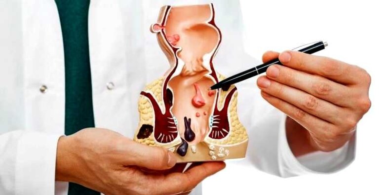 Proktolog - leczenie hemoroidów. Fot. mat. prasowy